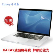 (笔记本电脑贴膜图片15.6英寸)观看最新笔记本电脑贴膜高清图片,保护你的电脑屏幕免受损坏 (笔记本电脑贴膜图片15.6英寸)观看最新笔记本电脑贴膜高清图片,保护你的电脑屏幕免受损坏